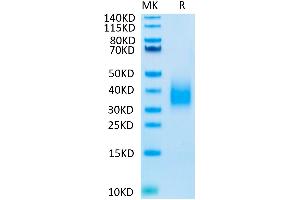 TREM2 Protein (His-Avi Tag,Biotin)