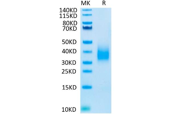 TREM2 Protein (His-Avi Tag,Biotin)