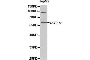 Western Blotting (WB) image for anti-UDP Glucuronosyltransferase 1 Family, Polypeptide A1 (UGT1A1) (AA 1-200) antibody (ABIN1683210) (UGT1A1 antibody  (AA 1-200))