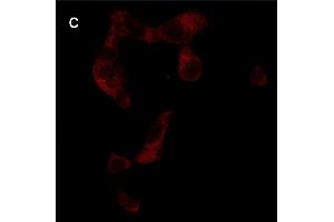 Detection of cathepsin B (CB) activity in Eca-109 cells by the CB probe. (Goat anti-Rabbit IgG Antibody (FITC))