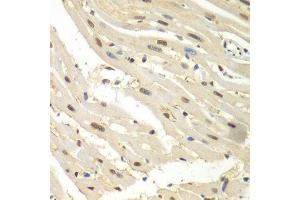 Immunohistochemistry of paraffin-embedded mouse heart using HDAC2 antibody. (HDAC2 antibody  (C-Term))