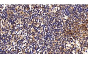 Detection of FAS in Porcine Lymph node Tissue using Polyclonal Antibody to Factor Related Apoptosis (FAS) (FAS antibody)