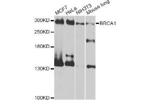Western blot analysis of extracts of various cell lines, using BRCA1 antibody (ABIN5997316) at 1/1000 dilution. (BRCA1 antibody)