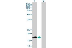 Western Blot analysis of IL20 expression in transfected 293T cell line by IL20 MaxPab polyclonal antibody. (IL-20 antibody  (AA 1-176))