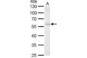 WB Image GBA antibody detects GBA protein by Western blot analysis. (GBA antibody  (Center))