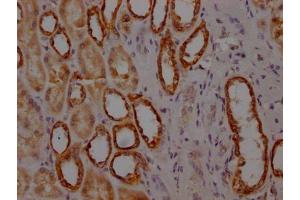 IHC image of ABIN7127634 diluted at 1:100 and staining in paraffin-embedded human kidney tissue performed on a Leica BondTM system. (Recombinant MYBBP1A antibody)