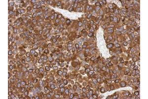 IHC-P Image Immunohistochemical analysis of paraffin-embedded PC13 xenograft, using AGR3, antibody at 1:500 dilution. (AGR3 antibody  (Center))