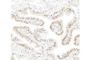 Immunohistochemistry (IHC) image for anti-Androgen Receptor (AR) (AA 1-50) antibody (ABIN7795785) (Recombinant Androgen Receptor antibody  (AA 1-50))