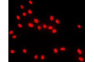 Immunofluorescent analysis of BACH1 staining in MCF7 cells. (BACH1 antibody  (Center))