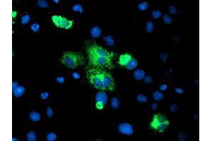 Image no. 4 for anti-Carboxypeptidase A2 (Pancreatic) (CPA2) antibody (ABIN1497595) (Carboxypeptidase A2 antibody)
