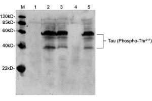 Western blot analysis of mouse brain tissue lysate using Rabbit Anti-Tau (Phospho-Thr217) Polyclonal Antibody (ABIN398308) Lane 1: Primary antibody negative controlLane 2: Rabbit Anti-Tau (Phospho-Thr217) Polyclonal AntibodyLane 3: Rabbit Anti-Tau (Phospho-Thr217) Polyclonal Antibody pre-incubated with non-phoshpo-peptideLane 4: Rabbit Anti-Tau (Phospho-Thr217) Polyclonal Antibody pre-incubated with phoshpo-peptideLane 5: Rabbit Anti-Tau (Phospho-Thr217) Polyclonal Antibody pre-incubated with generic phospho-threonine containing peptideSecondary antibody: Goat Anti-Rabbit IgG (H&L) [HRP] Polyclonal Antibody (ABIN398323) The signal was developed with LumiSensorTM HRP Substrate Kit (ABIN769939)