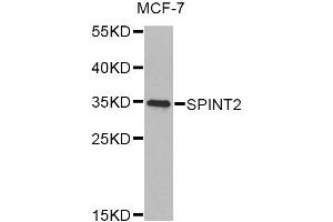 Western blot analysis of extracts of MCF-7 cells, using SPINT2 Antibody (ABIN2560117) at 1:1000 dilution. (SPINT2 antibody)