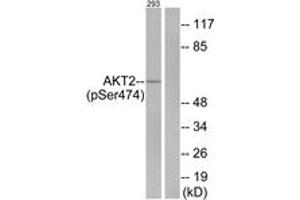 Western blot analysis of extracts from 293 cells treated with EGF 200ng/ml 30', using Akt2 (Phospho-Ser474) Antibody. (AKT2 antibody  (pSer474))
