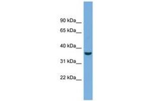 Image no. 1 for anti-Crystallin, mu (CRYM) (AA 71-120) antibody (ABIN6743607) (CRYM antibody  (AA 71-120))