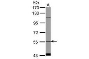 Image no. 1 for anti-Cytidine and DCMP Deaminase Domain Containing 1 (CDADC1) (AA 279-501) antibody (ABIN1497387) (CDADC1 antibody  (AA 279-501))
