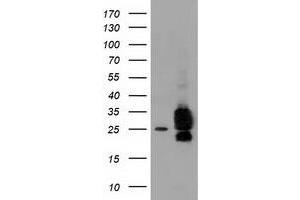 Western Blotting (WB) image for anti-ClpP Caseinolytic Peptidase, ATP-Dependent, Proteolytic Subunit Homolog (E. Coli) (CLPP) antibody (ABIN1497535) (CLPP antibody)