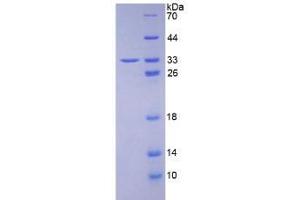 SDS-PAGE analysis of Human HABP1 Protein.