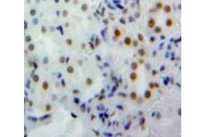 Used in DAB staining on fromalin fixed paraffin-embedded Kidney tissue (NUP160 antibody  (AA 11-206))