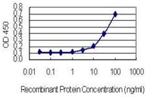 Detection limit for recombinant GST tagged HARS is 0. (HARS1/Jo-1 antibody  (AA 1-96))