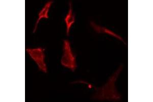 ABIN6275088 staining  Hela cells by IF/ICC. (MARCH3 antibody  (Internal Region))