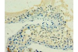 Immunohistochemistry of paraffin-embedded human testis tissue using ABIN7154927 at dilution of 1:100 (HSPA2 antibody  (AA 400-639))