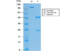 SDS-PAGE Analysis Purified CEA Mouse Recombinant Monoclonal Antibody (rC66/1009). (Recombinant CEACAM5 antibody)