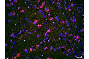 Formalin-fixed and paraffin embedded rat brain labeled with Anti-CACNA1G/Cav3. (CACNA1G antibody  (AA 901-1000))