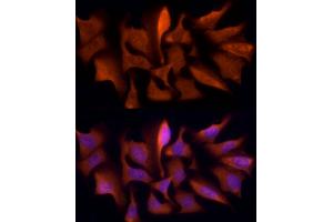 Immunofluorescence analysis of U2OS cells using PSMC5 Rabbit mAb (ABIN7269585) at dilution of 1:50 (40x lens).