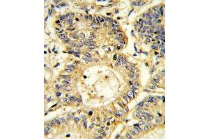 Immunohistochemistry (IHC) image for anti-Suppressor of Cytokine Signaling 1 (SOCS1) antibody (ABIN3003913) (SOCS1 antibody)