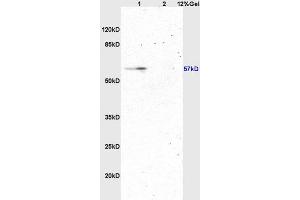 Lane 1: rat brain lysates Lane 2: rat kidney lysates probed with Anti ATG13 Polyclonal Antibody, Unconjugated (ABIN750313) at 1:200 in 4 °C.