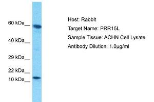 Host: Rabbit Target Name: PRR15L Sample Tissue: Human ACHN Whole Cell Antibody Dilution: 1ug/ml (PRR15L antibody  (C-Term))