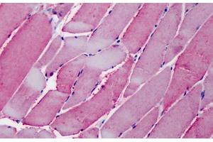 Human Skeletal Muscle: Formalin-Fixed, Paraffin-Embedded (FFPE) (OSBPL1A antibody  (AA 938-950))