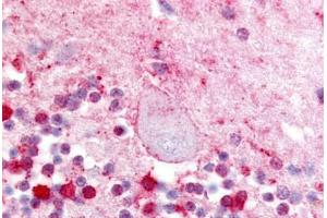 Human Brain, Cerebellum  (formalin-fixed, paraffin-embedded) stained with LPAR5 antibody ABIN213472 at 10 ug/ml followed by biotinylated goat anti-rabbit IgG secondary antibody ABIN481713, alkaline phosphatase-streptavidin and chromogen. (LPAR5 antibody  (Extracellular Domain))