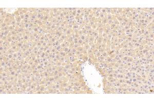 Detection of LDLR in Mouse Liver Tissue using Polyclonal Antibody to Low Density Lipoprotein Receptor (LDLR) (LDLR antibody  (AA 263-509))