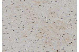 ABIN6273076 at 1/100 staining Rat heart tissue by IHC-P. (SRP68 antibody  (C-Term))