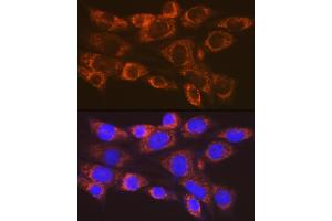 Immunofluorescence analysis of NIH-3T3 cells using  Rabbit mAb (ABIN7265479) at dilution of 1:100 (40x lens). (ARF1 antibody)
