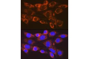 Immunofluorescence analysis of NIH-3T3 cells using  Rabbit mAb (ABIN7265479) at dilution of 1:100 (40x lens).