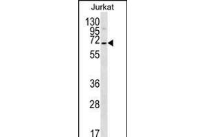 PSAPL1 antibody  (N-Term)