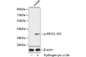 Western blot analysis of extracts from Jurkat cells using Phospho-eIF2α(S51) Polyclonal Antibody. (EIF2A antibody  (pSer51))