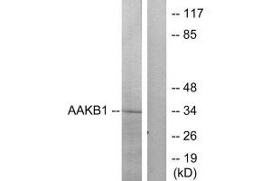 Western Blotting (WB) image for anti-Protein Kinase, AMP-Activated, beta 1 Non-Catalytic Subunit (PRKAB1) (N-Term) antibody (ABIN1850404) (PRKAB1 antibody  (N-Term))