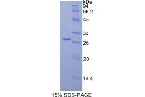 SDS-PAGE analysis of Human MCAM Protein. (MCAM Protein)