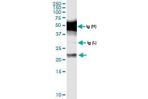 Immunoprecipitation of CENPN transfected lysate using anti-CENPN MaxPab rabbit polyclonal antibody and Protein A Magnetic Bead , and immunoblotted with CENPN MaxPab rabbit polyclonal antibody (D01) . (CENPN antibody  (AA 1-204))