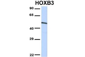 Host:  Rabbit  Target Name:  CCNT1  Sample Type:  MCF7  Antibody Dilution:  1. (Cyclin T1 antibody  (N-Term))