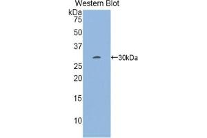 Detection of Recombinant EGR2, Mouse using Polyclonal Antibody to Early Growth Response Protein 2 (EGR2) (EGR2 antibody  (AA 150-407))
