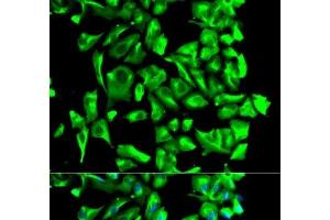 Immunofluorescence analysis of U2OS cells using HSP90AB1 Polyclonal Antibody (HSP90AB1 antibody)