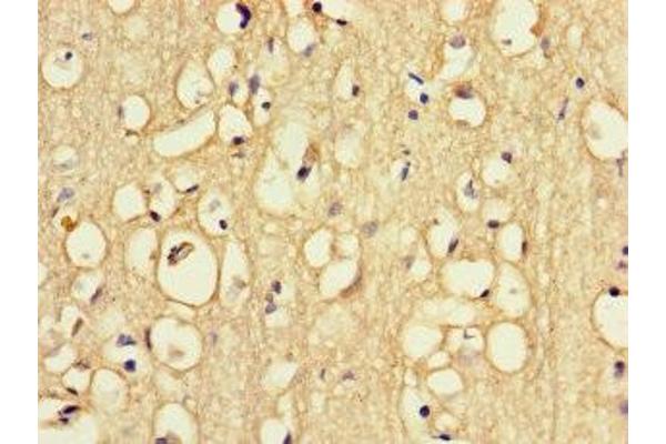 Riboflavin Kinase antibody  (AA 1-154)