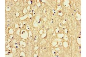 Immunohistochemistry of paraffin-embedded human brain tissue using ABIN7168091 at dilution of 1:100 (Riboflavin Kinase antibody  (AA 1-154))