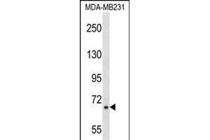 ZNF44 Antibody (N-term) (ABIN1539529 and ABIN2850156) western blot analysis in MDA-M cell line lysates (35 μg/lane). (Zinc Finger Protein 44 antibody  (N-Term))