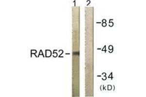 Western blot analysis of extracts from 293 cells, using RAD52 (Ab-104) Antibody. (RAD52 antibody  (AA 70-119))