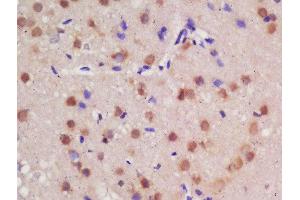 Formalin-fixed and paraffin embedded rat brain labeled with Rabbit Anti-Guanylyl Cyclase alpha 1 Polyclonal Antibody, Unconjugated  at 1:200 followed by conjugation to the secondary antibody and DAB staining (GUCY1A1 antibody  (AA 301-400))